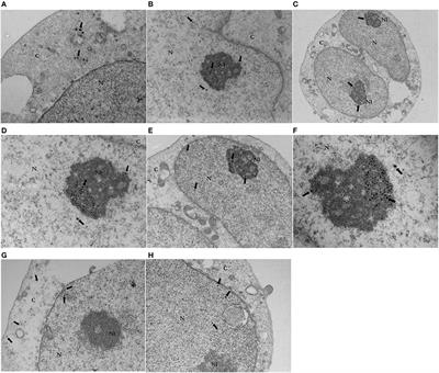 Ultrastructural Localization and Molecular Associations of HCV Capsid Protein in Jurkat T Cells